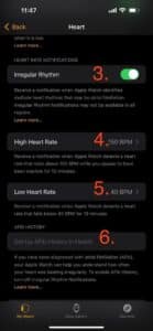 การใช้นาฬิกา smart watch เพื่อตรวจจับภาวะหัวใจเต้นผิดจังหวะ (2)